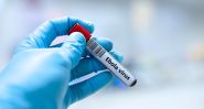 Ebola: le vaccin «le plus prometteur» selon l'OMS va être développé par un groupe singapourien