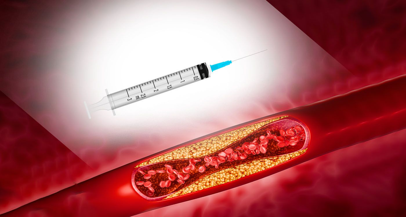 Cholestérol: une injection pour en finir avec les comprimés à vie?