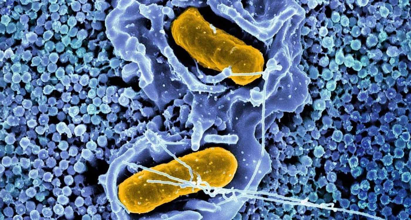 Salmonelle et typhoïde au Liban: faut-il s’inquiéter cet été?