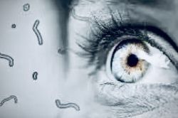 Les myodésopsies ou mouches volantes: phénomène banal ou urgence oculaire?