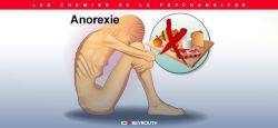 Les TCA - (2) Témoignage sur l’anorexie mentale