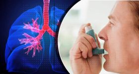 Asthme: le Liban à bout de souffle