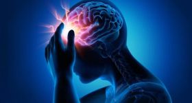 Migraine: quand les crises prennent le contrôle du quotidien