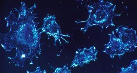Pancréas, désescalade thérapeutique et Ozempic: des avancées sur le front de la lutte anti-cancer