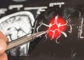 Journée mondiale d’Alzheimer
