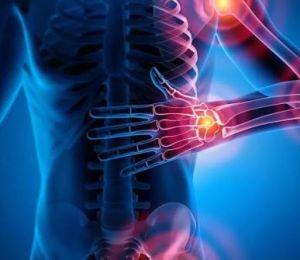 Arthrite: au Liban, reconnaître les signes pour agir plus tôt