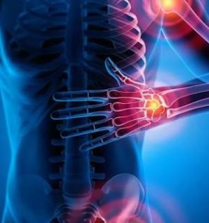 Arthrite: au Liban, reconnaître les signes pour agir plus tôt