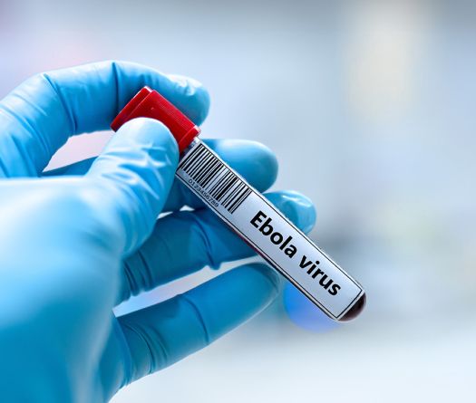 Ebola: le Liban suit de près la situation en Afrique et renforce la surveillance sanitaire