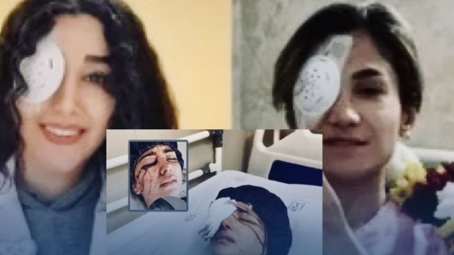 Iran: le pouvoir qui vise les yeux, ou la guerre faite au regard