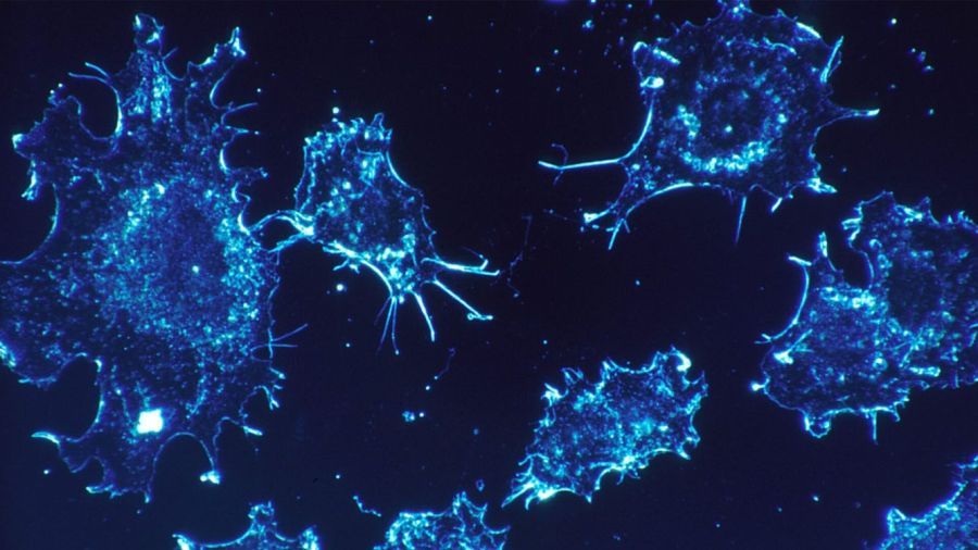 Pancréas, désescalade thérapeutique et Ozempic: des avancées sur le front de la lutte anti-cancer