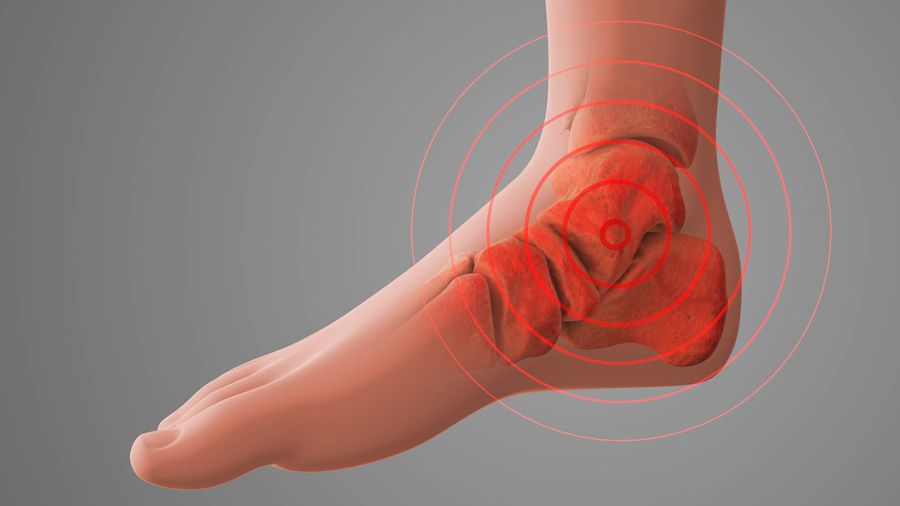 L’arthrose ne ferait pas mal ? Le mythe qui bouscule nos certitudes